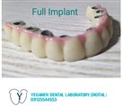 لابراتوار دیجیتال تخصصی پروتزهای دندانی یگانه - ایمپلنت