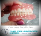 لابراتوار تخصصی پروتزهای دندانی یگانه - دندان مصنوعی