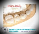 لابراتوار تخصصی پروتزهای دندانی یگانه - Zirconia