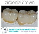 لابراتوار دیجیتال تخصصی پروتزهای دندانی یگانه - Zirconia