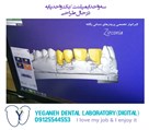 لابراتوار دیجیتال تخصصی پروتزهای دندانی یگانه - ایمپلنت/زیرکونیا