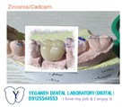 لابراتوار دیجیتال تخصصی پروتزهای دندانی یگانه - Zirconia