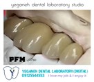 لابراتوار تخصصی پروتزهای دندانی یگانه - Zirconia