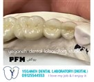 لابراتوار دیجیتال تخصصی پروتزهای دندانی یگانه - Zirconia