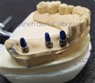 لابراتوار دیجیتال تخصصی پروتزهای دندانی یگانه - ایمپلنت