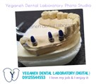 لابراتوار دیجیتال تخصصی پروتزهای دندانی یگانه - ایمپلنت/زیرکونیا