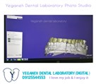 لابراتوار تخصصی پروتزهای دندانی یگانه - ایمپلنت/زیرکونیا