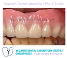 لابراتوار دیجیتال تخصصی پروتزهای دندانی یگانه - دندان مصنوعی