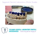 لابراتوار دیجیتال تخصصی پروتزهای دندانی یگانه - PFM