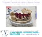 لابراتوار دیجیتال تخصصی پروتزهای دندانی یگانه - ایمپلنت/زیرکونیا