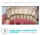 لابراتوار دیجیتال تخصصی پروتزهای دندانی یگانه - اوردنچر