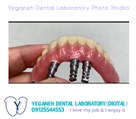 لابراتوار تخصصی پروتزهای دندانی یگانه - اوردنچر