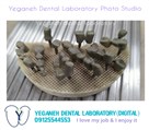 لابراتوار تخصصی پروتزهای دندانی یگانه - دندانسازی یگانه