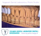 لابراتوار دیجیتال تخصصی پروتزهای دندانی یگانه - ایمپلنت/زیرکونیا