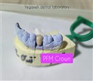 لابراتوار دیجیتال تخصصی پروتزهای دندانی یگانه - تصویر 81594
