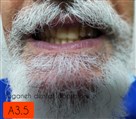 لابراتوار تخصصی پروتزهای دندانی یگانه - تصویر 81597