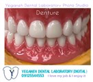 لابراتوار دیجیتال تخصصی پروتزهای دندانی یگانه - ایمپلنت/زیرکونیا