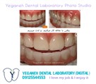 لابراتوار دیجیتال تخصصی پروتزهای دندانی یگانه - ایمپلنت/زیرکونیا