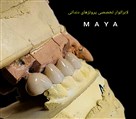 لابراتوار تخصصی دیجیتال پروتزهای دندانی مایا - مایا پروتز