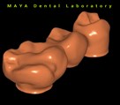 لابراتوار تخصصی دیجیتال پروتزهای دندانی مایا - مایا پروتز