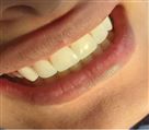 مطب دندانپزشکی دکتر نسرین عبدی - تصویر 78381