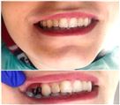 دندانپزشکی دکتر الهه عبدی - تصویر 80048