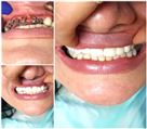 دندانپزشکی دکتر الهه عبدی - تصویر 80049