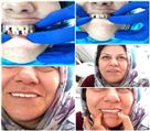 دندانپزشکی دکتر الهه عبدی - تصویر 80050