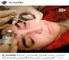 کلینیک تخصصی زیبایی دکتر حمید مُشگی - مزوتراپی