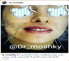 کلینیک تخصصی زیبایی دکتر حمید مُشگی - لیفت صورت با طب سوزنی