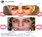 کلینیک تخصصی زیبایی دکتر حمید مُشگی - جراحی پلک