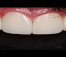 کلینیک دندانپزشکی دکتر مرجان ایمانی - تصویر 87752