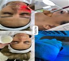 آموزش پاکسازی و فیشال و خدمات فیشال یلدا - تصویر 115756
