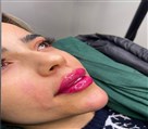 کلینیک لیزر و زیبایی نیلوفر - تصویر 118666