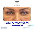 دکتر افشین تاج دینی (جراح و متخصص چشم) - تصویر 90408