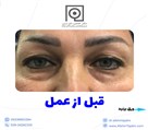 دکتر افشین تاج دینی (جراح و متخصص چشم) - تصویر 90409