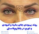 دکتر افشین تاج دینی (جراح و متخصص چشم) - تصویر 90410