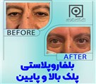 دکتر افشین تاج دینی (جراح و متخصص چشم) - تصویر 92246