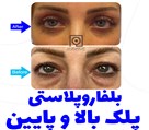 دکتر افشین تاج دینی (جراح و متخصص چشم) - تصویر 92250