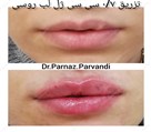 کلینیک پوست، مو، زیبایی و لیزر دکتر پرناز پروندی - تصویر 89042