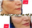 کلینیک پوست، مو، زیبایی و لیزر دکتر پرناز پروندی - تصویر 89045
