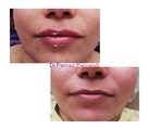 کلینیک پوست، مو، زیبایی و لیزر دکتر پرناز پروندی - تصویر 94078