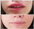کلینیک پوست، مو، زیبایی و لیزر دکتر پرناز پروندی - تصویر 96162