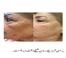 خدمات تخصصی و درمان پوست پریا - تصویر 132185