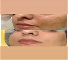 خدمات تخصصی و درمان پوست پریا - تصویر 96748