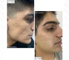 خدمات تخصصی و درمان پوست پریا - تصویر 96762