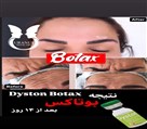 كلينيك تخصصي جوانسازي و لاغري اورانوس - بوتاکس پیشانی و دور چشم