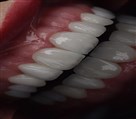 دکتر نازنین حق شناس (دندانپزشک زیبایی) - تصویر 93300