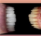 دکتر نازنین حق شناس (دندانپزشک زیبایی) - تصویر 93302