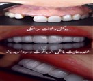 دکتر نازنین حق شناس (دندانپزشک زیبایی) - تصویر 93304